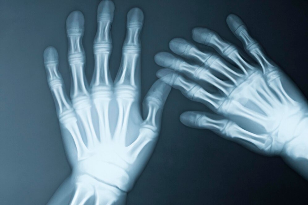 Xray Hand Cost in Nagpur