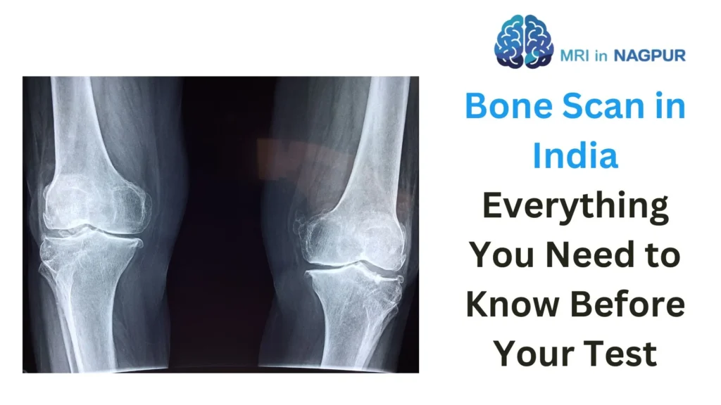 Bone Scan In Nagpur