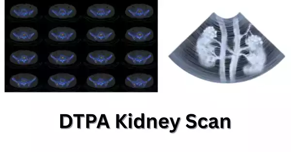 why does the patient need to go for dtpa kidney scan