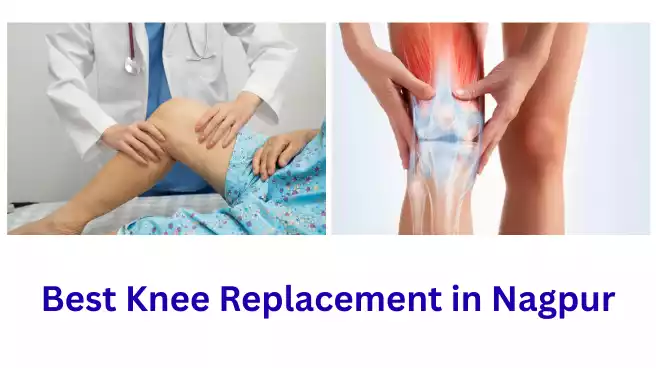 Best Knee Replacement in Nagpur