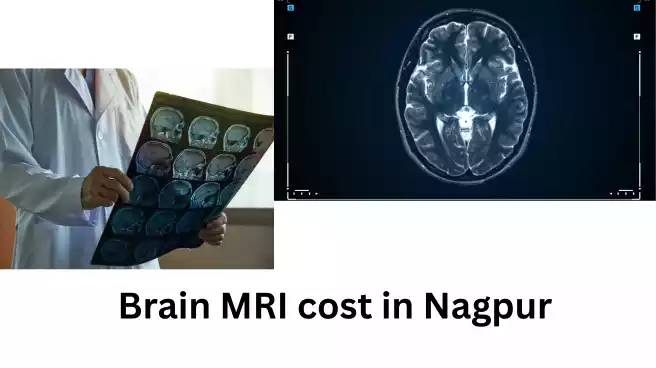 Brain MRI cost in Nagpur